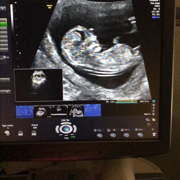 Meet your Posher, Antonio - Picture 1 of 1